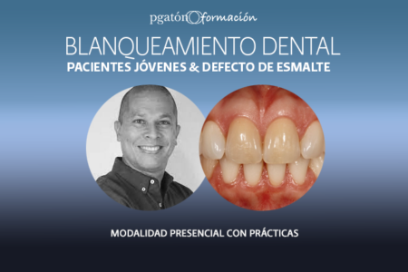 Curso blanqueamiento dental