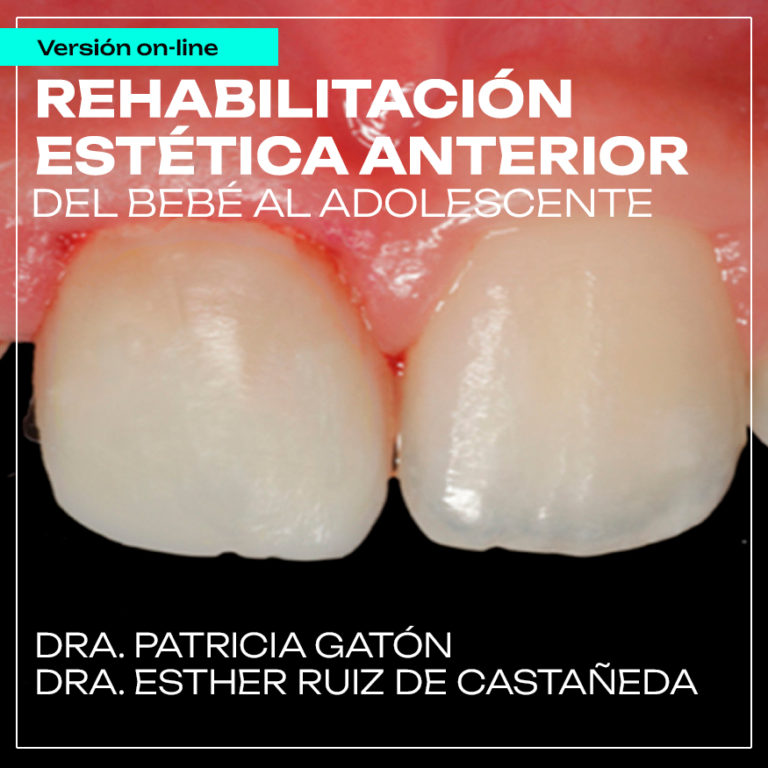 Curso Restauración Estética Anterior en Odontopediatría